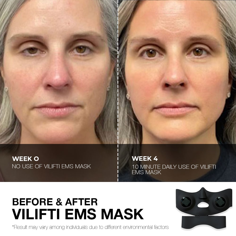 VILIFTI High-Performance EMS Mask