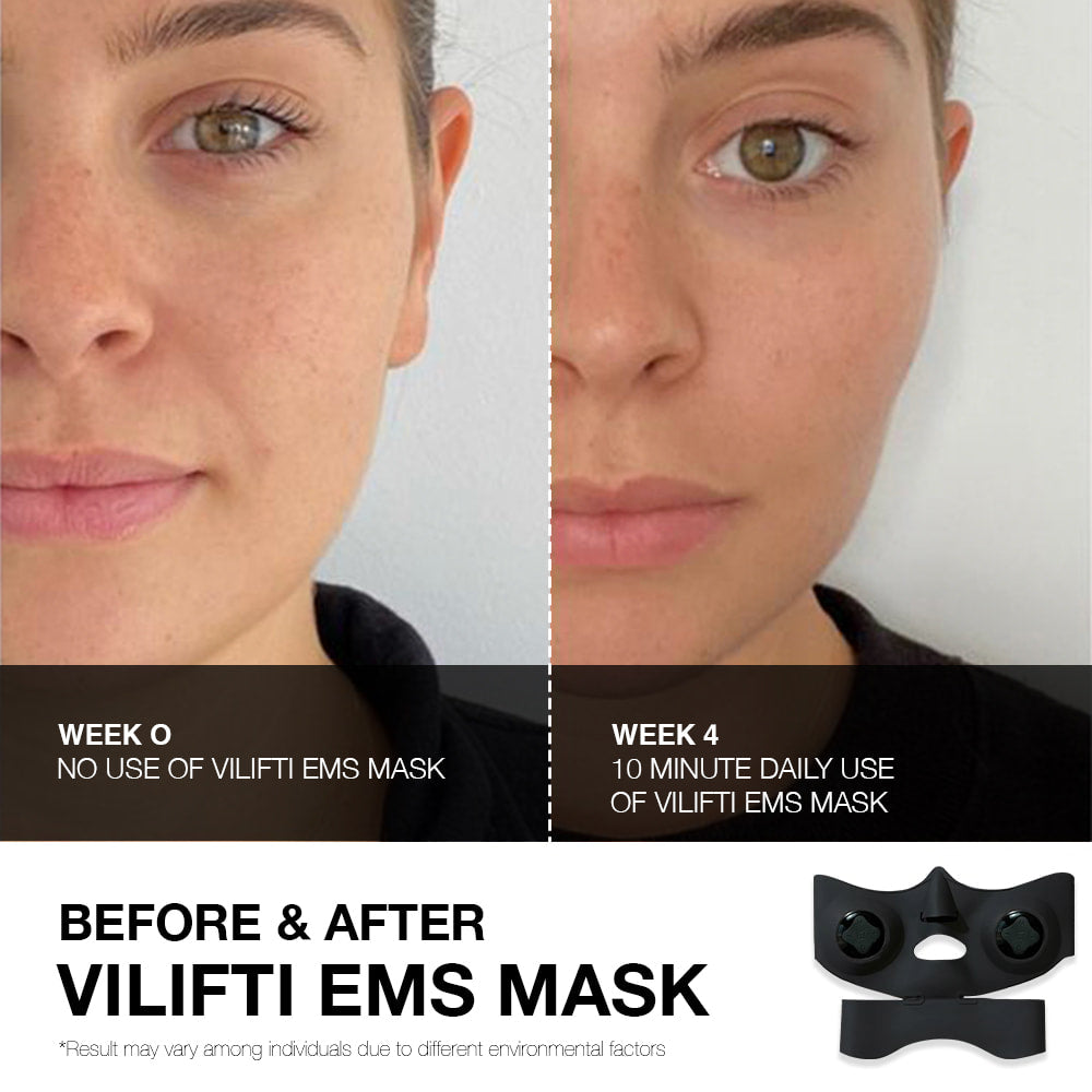 VILIFTI High-Performance EMS Mask